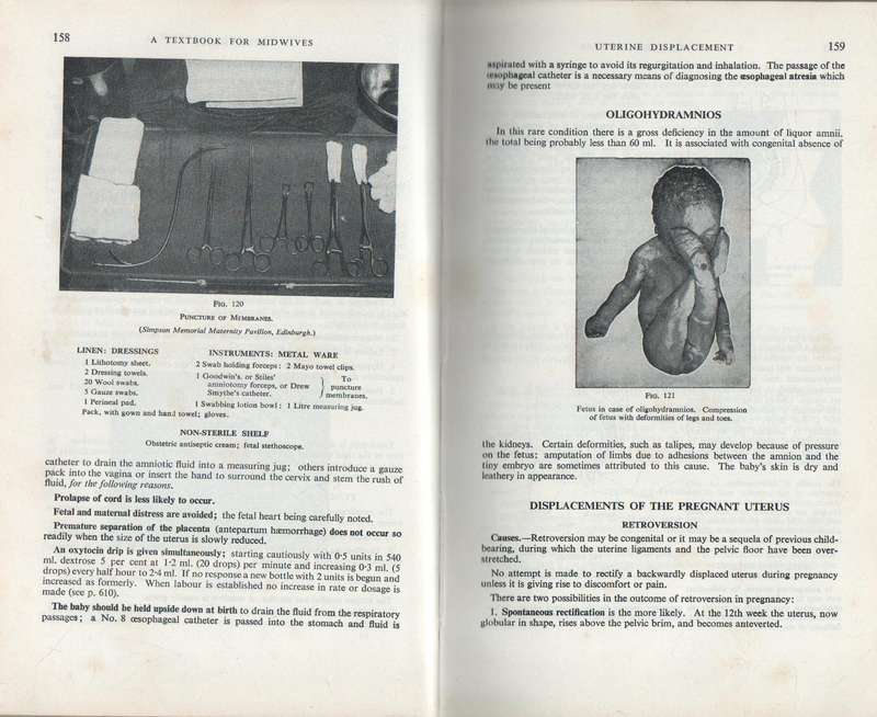 TEXTBOOK FOR MIDWIVES - MARGARET MYLES ( SEVENTH EDITION 1971)