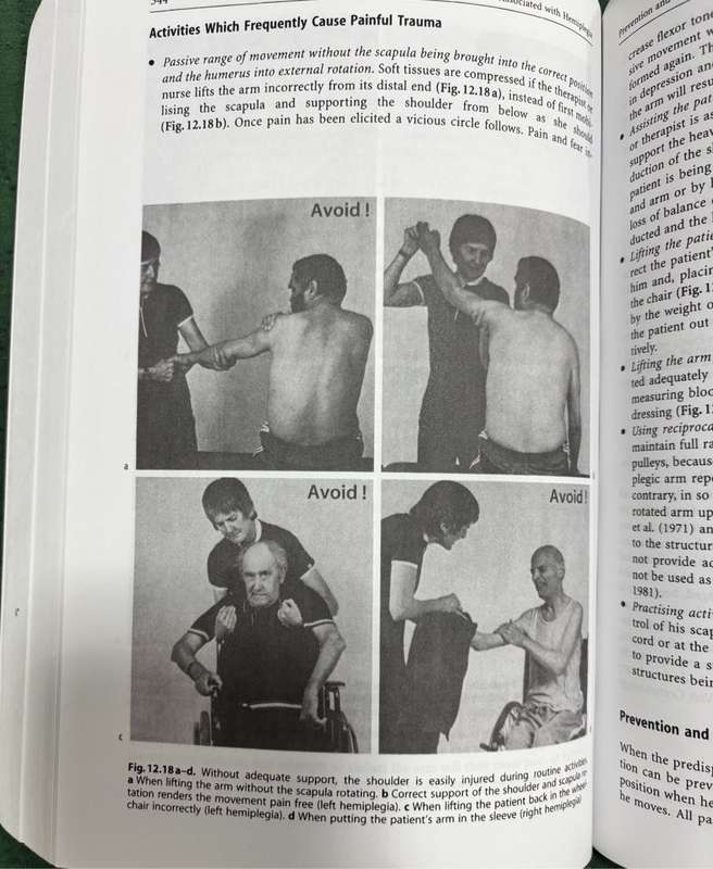 Steps to Follow Comprehensive Treatment of Patients with Hemiplegia 2nd Edition Patricia Davies