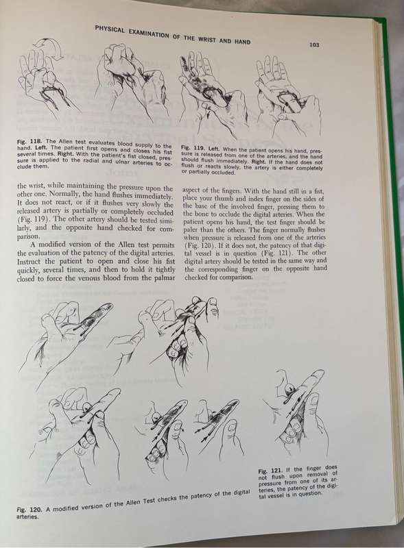 Physical Examination of the Spine and Extremities by Stanley Hoppenfeld