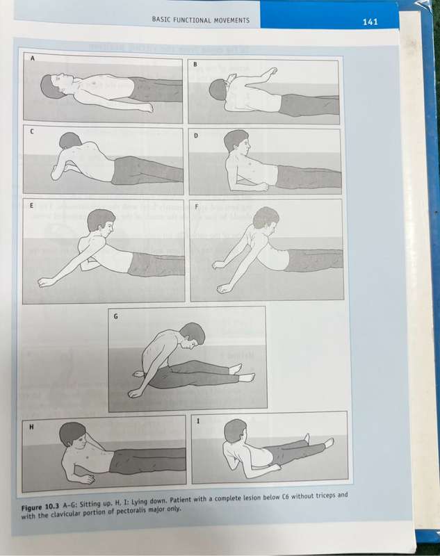 Tetraplegia and Paraplegia Guide for PHYSIOTHERAPISTS 6th Edition Ida Bromley