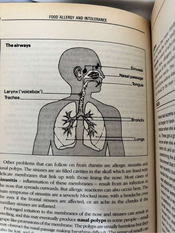The Complete Guide to Food Allergy and Intolerance Professor Jonathan Brostoff and Linda Gamlin