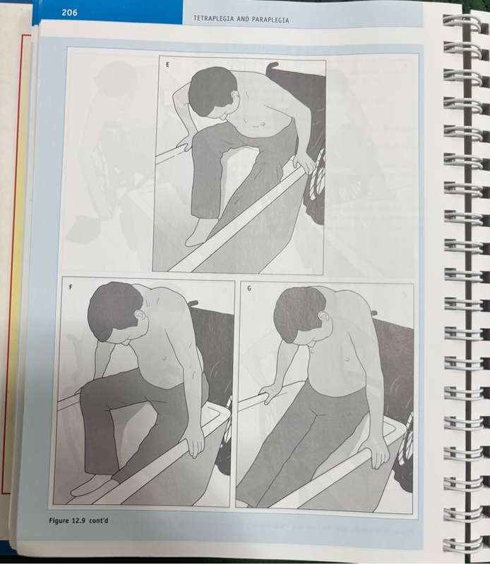 Tetraplegia and Paraplegia Guide for PHYSIOTHERAPISTS 6th Edition Ida Bromley