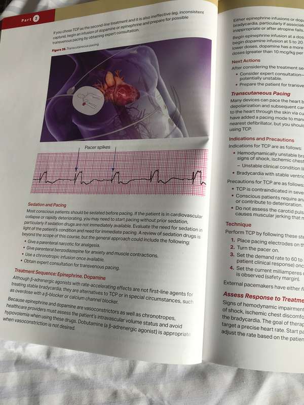 ACLS Advance Cardiovascular  Life Support Provider Manual American Heart Association