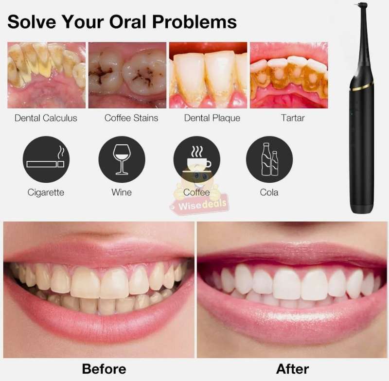 High-Speed Acoustic Vibration Electric Toothbrush and Grinding Heads