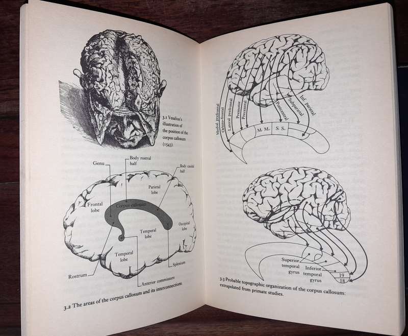 The Brain