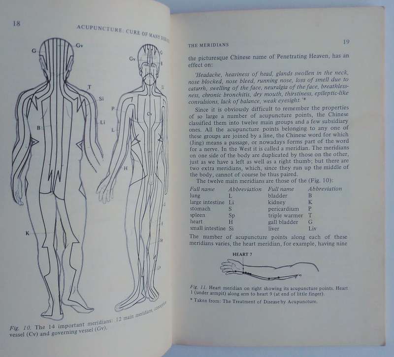 Acupuncture Cure of Many Diseases by Dr Felix Mann