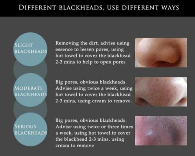 Deep Cleansing Purifying Black Face Mask