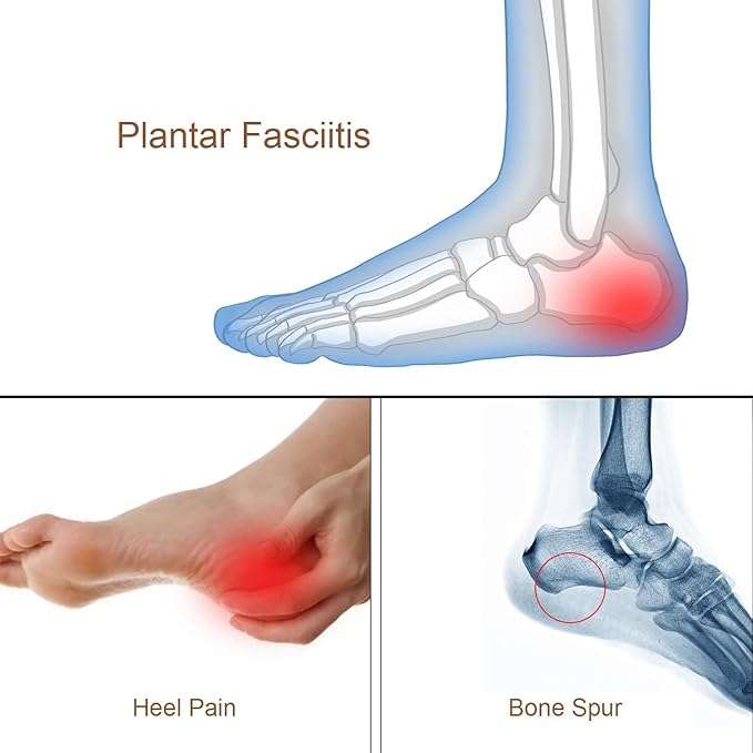 Silicone Gel Heel Cups - Shoe Inserts for Sore Heel Pain, Bone Spur & Achilles Pain- 1 Pair