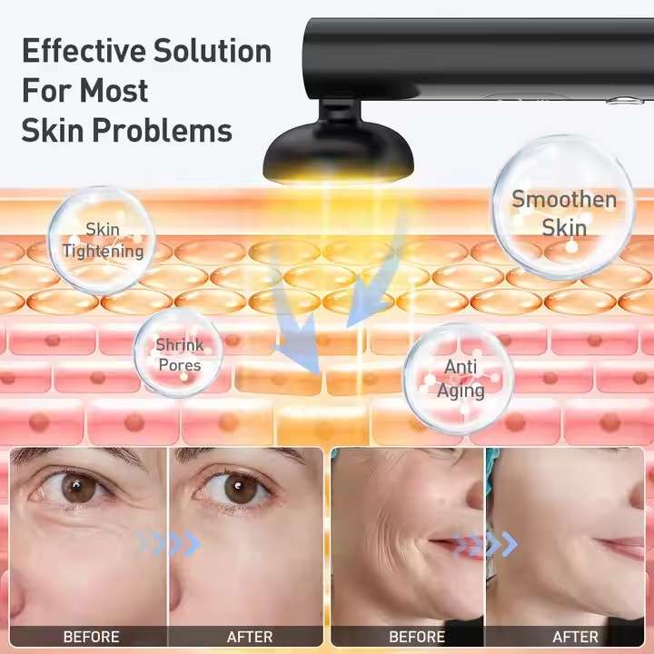 9-in-1 Face & Eye Beauty Wand