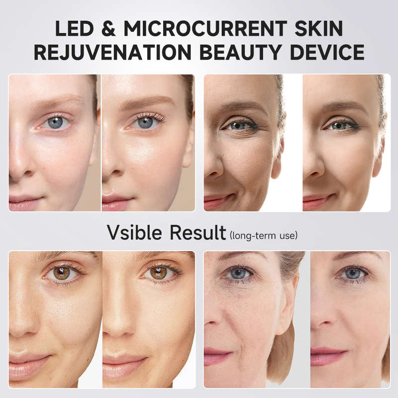 Age Booster Pro Microcurrent Facial Device | LED Therapy & Skin Rejuvenation