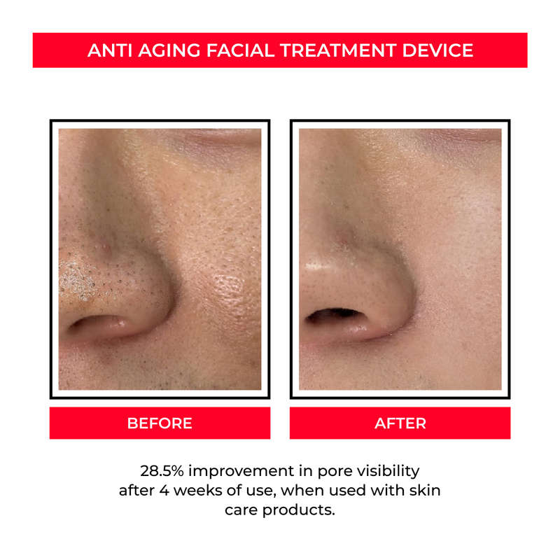 Facial Treatment Device for Enhancing Skin Care Absorption