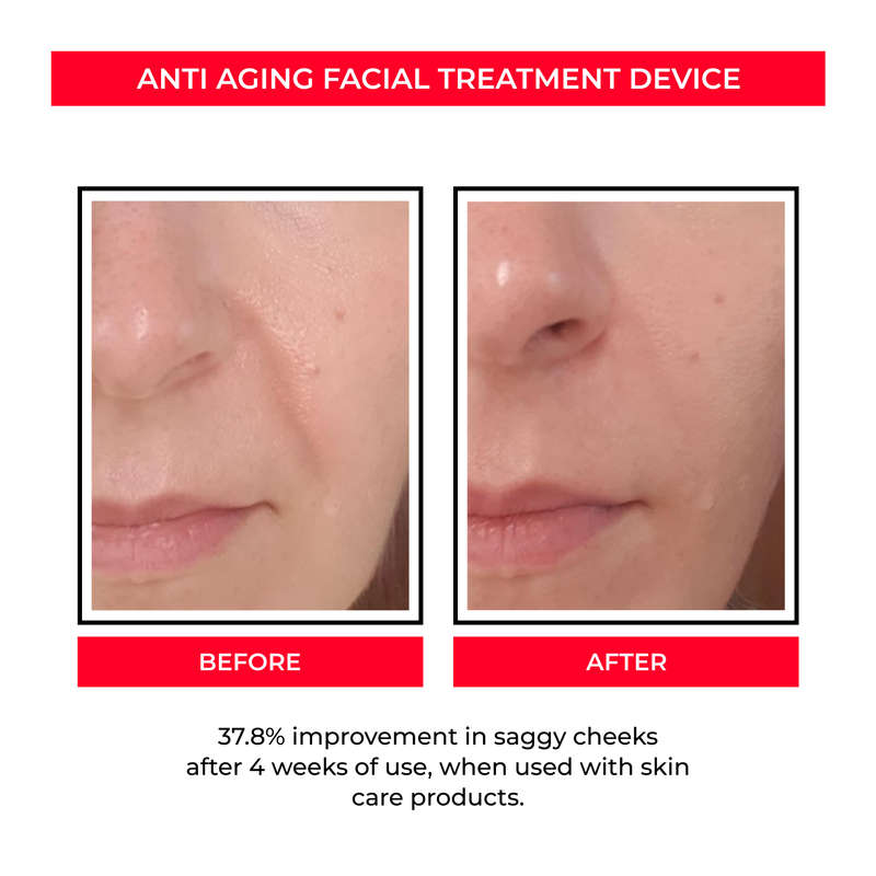 Facial Treatment Device for Enhancing Skin Care Absorption