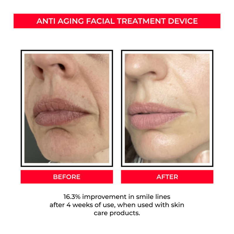 Facial Treatment Device for Enhancing Skin Care Absorption