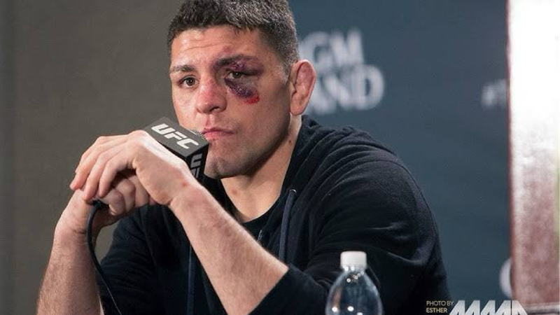 UFC Glove Signed Nick Diaz Boxed with Vinyl Decals