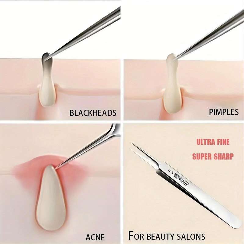 1 Pack Extra Fine Cellular Acne Blackhead Tweezers