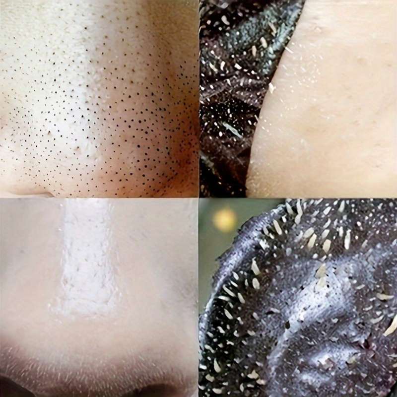 10pcs Deep Cleansing Nose Strips