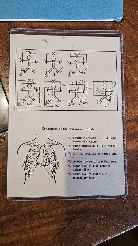 Nihon Kohden Electrocardiograph