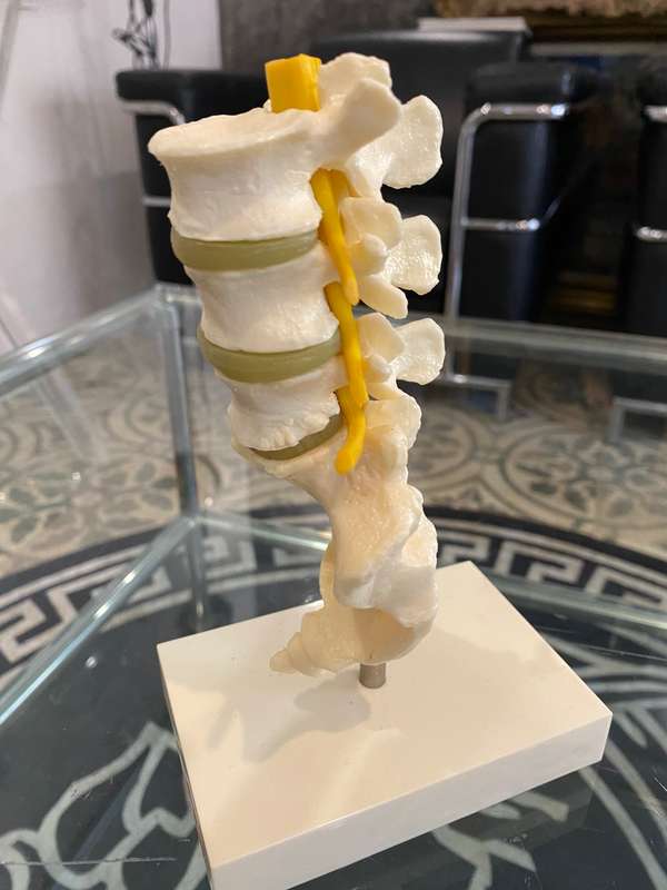 Voltaren Geigy Spine