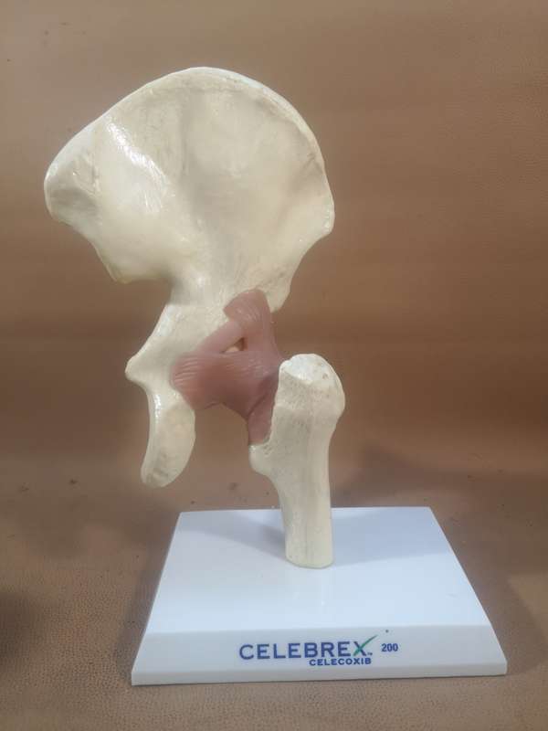 Celebrex 200 Medical Anatomical Model Hip Femur Pelvis