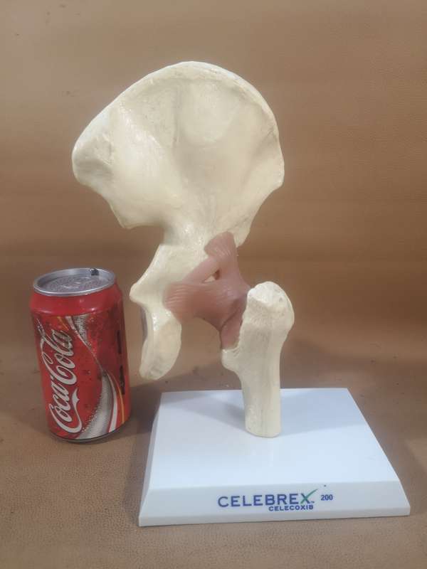 Celebrex 200 Medical Anatomical Model Hip Femur Pelvis