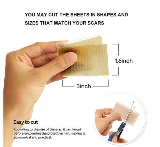 Advanced Reusable Silicone Scar Tape 4x150cm