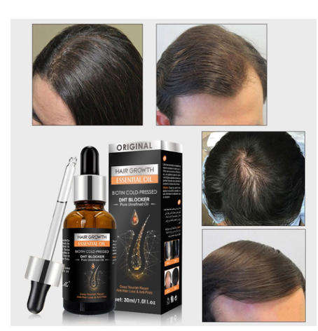 Original Biotin Cold Pressed Hair Growth Shampoo & Biotin Essential Oil
