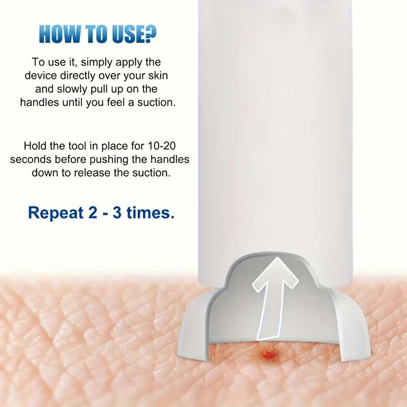 Bug Bite Removal Tool, Portable Venom Extractor