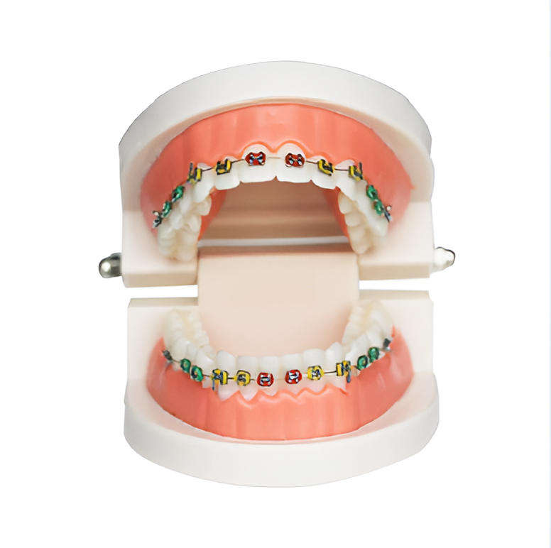 Dental Orthodontic Model