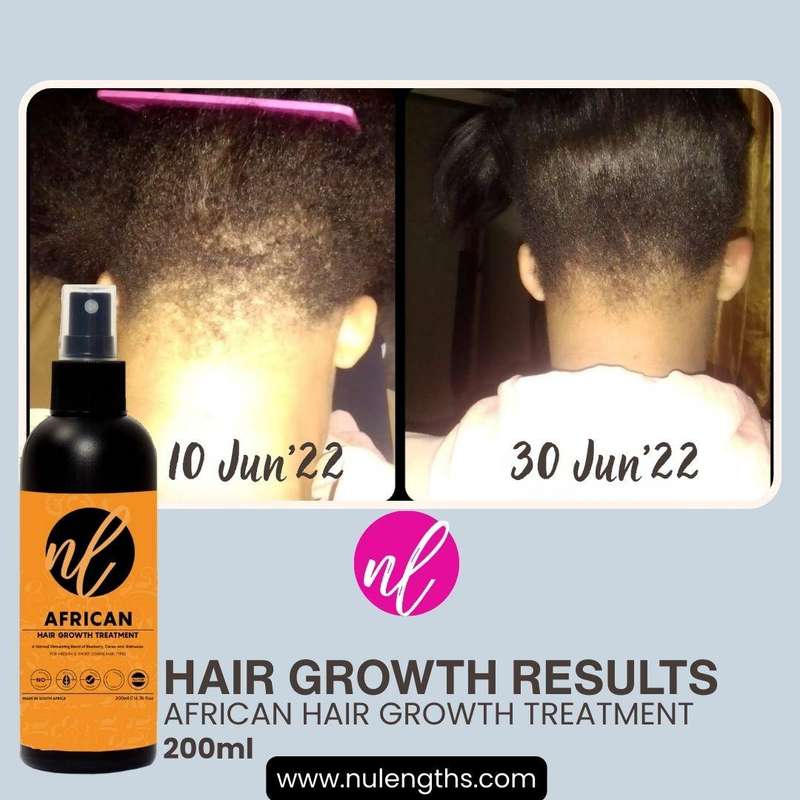 African Hair Growth Treatment 200ml