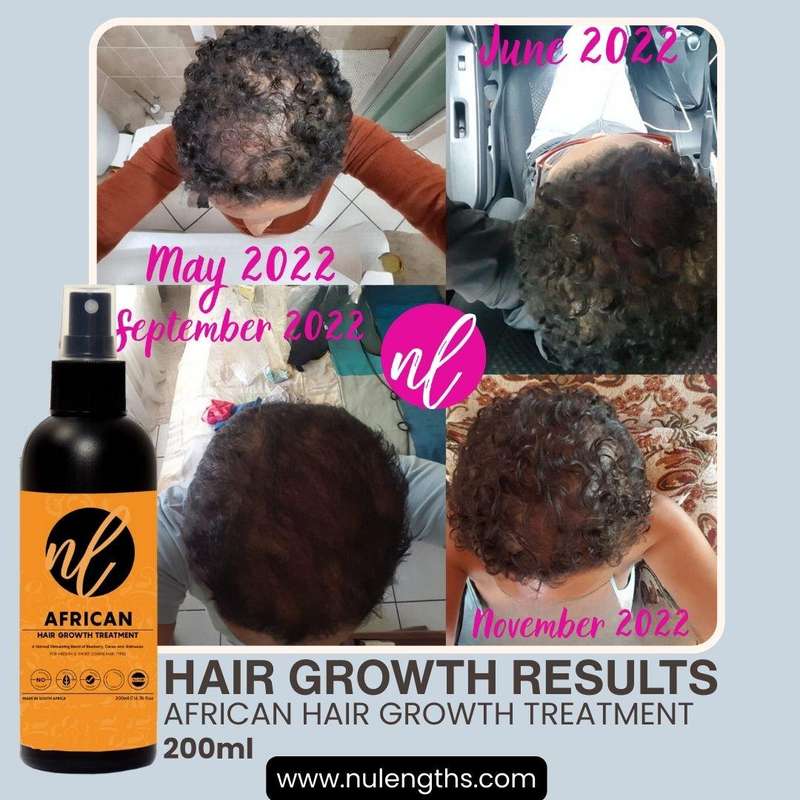 African Hair Growth Treatment 200ml