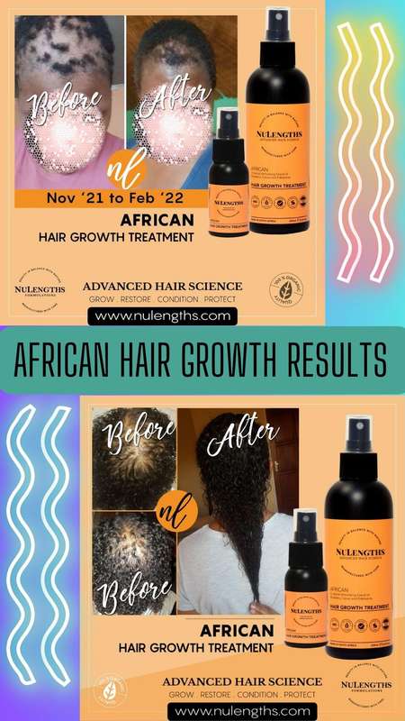 African Hair Growth Treatment 200ml