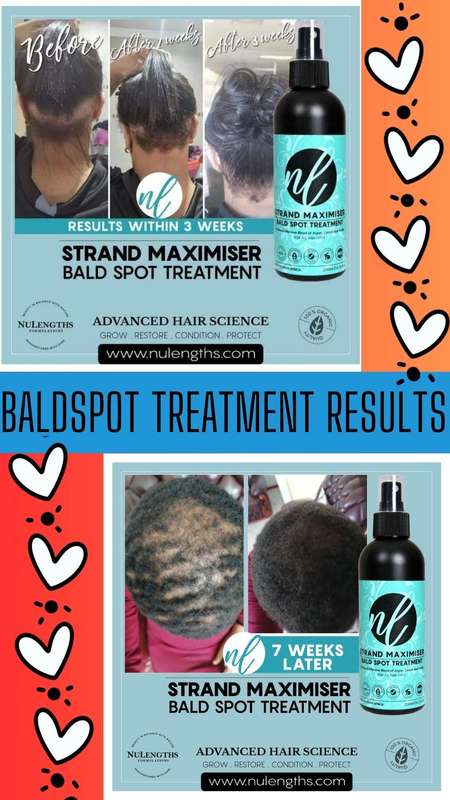 Strand Max Bald Spot Treatment 200ml