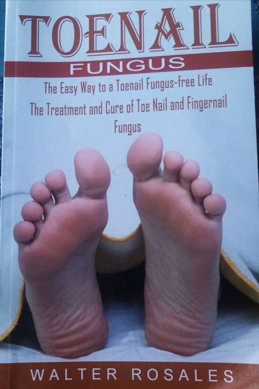 Toenail Fungus: The Easy Way to a Toenail Fungus-Free Life