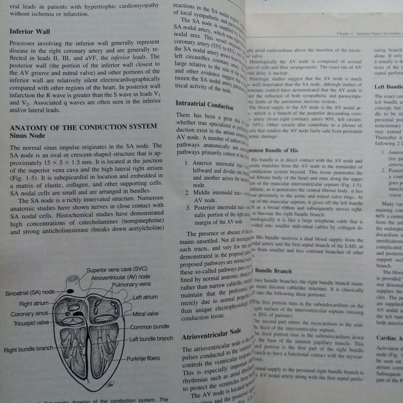 Cardiac Rhythm Disorders, Second Edition  A Nursing Process Approach by Patricia Lounsbury