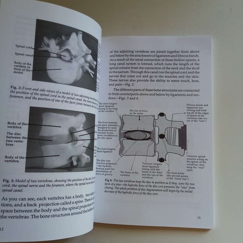 How to Deal with Back Pain and Rheumatoid Joint Pain  F. Batmanghelidj (Paperback)