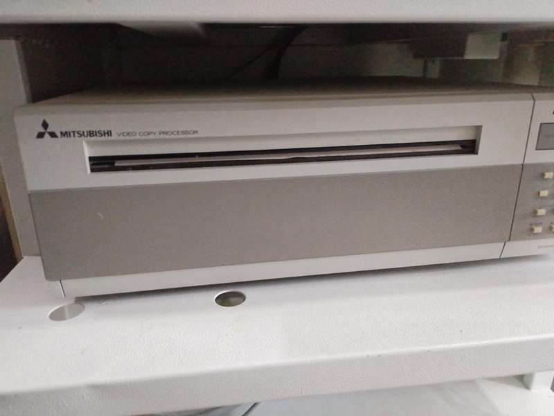 Toshiba SSA-220A Diagnostic Ultrasound Machine - Fully Functional
