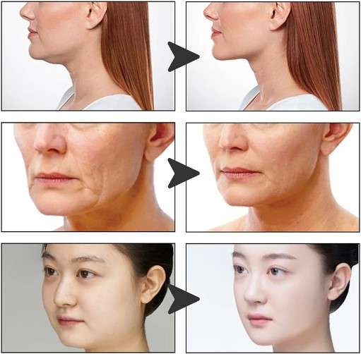 Ultra Thin V Face Tapes Stickers Makeup Face Lift Patch Tape