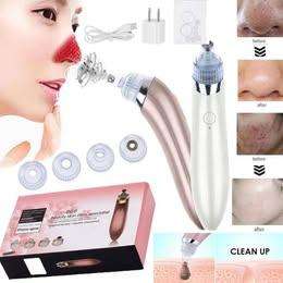 Electric Blackhead Suction Tool Pore Cleanser (White)