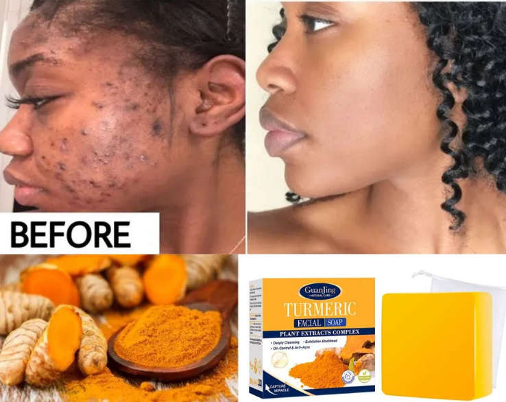 Korean Turmeric Facial Soap