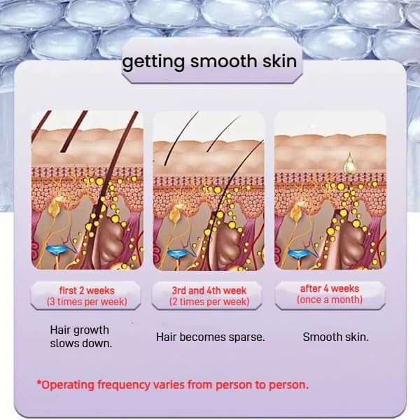 Laser Hair Removal Unisex Handheld Intense Pulsed Light with  Ice Cooling