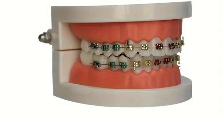 Fashion braces