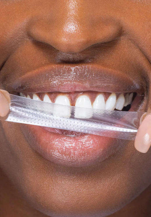 HiSmile PAP+ Whitening Strips