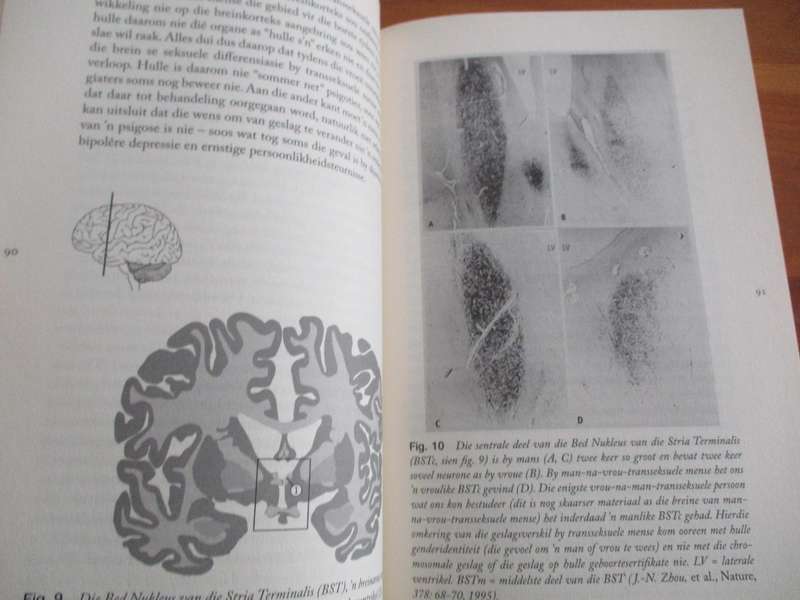 EK IS MY BREIN. Van Baarmoeder tot Alzheimer. DICK SWAAB