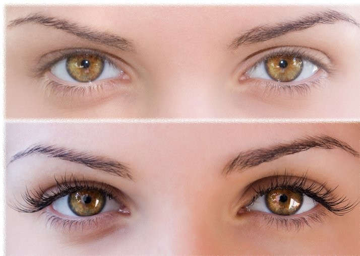 sectioning clip - claw type ( white)