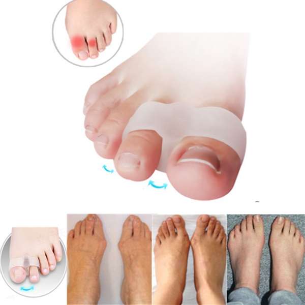 2Pcs Soft Gel Toe Separators Stretchers Bunion Protector