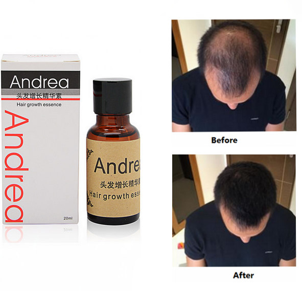 Fast Hair Growth Essence Liquid Pilatory For Men And Women 20ml *Free Shipping