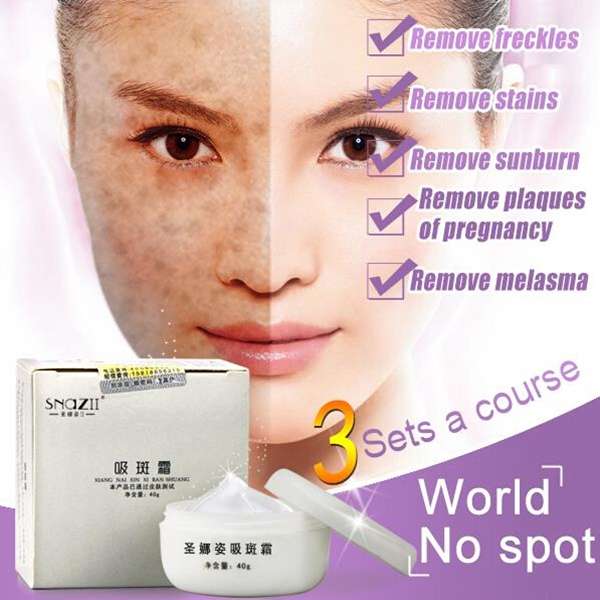 SNAZII Freckle Spot Removal Remover Repair Whitening Facial Eliminate Melanin Cream Moisturizing