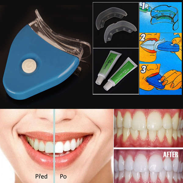 Home Use Teeth Whitening Bleaching Gel Kit