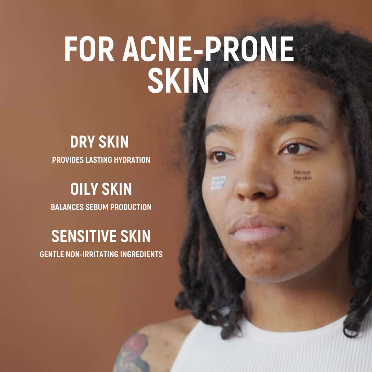 Acne.org.za - HYDRATE - Anti-inflammatory & Deep nourishing moisturiser