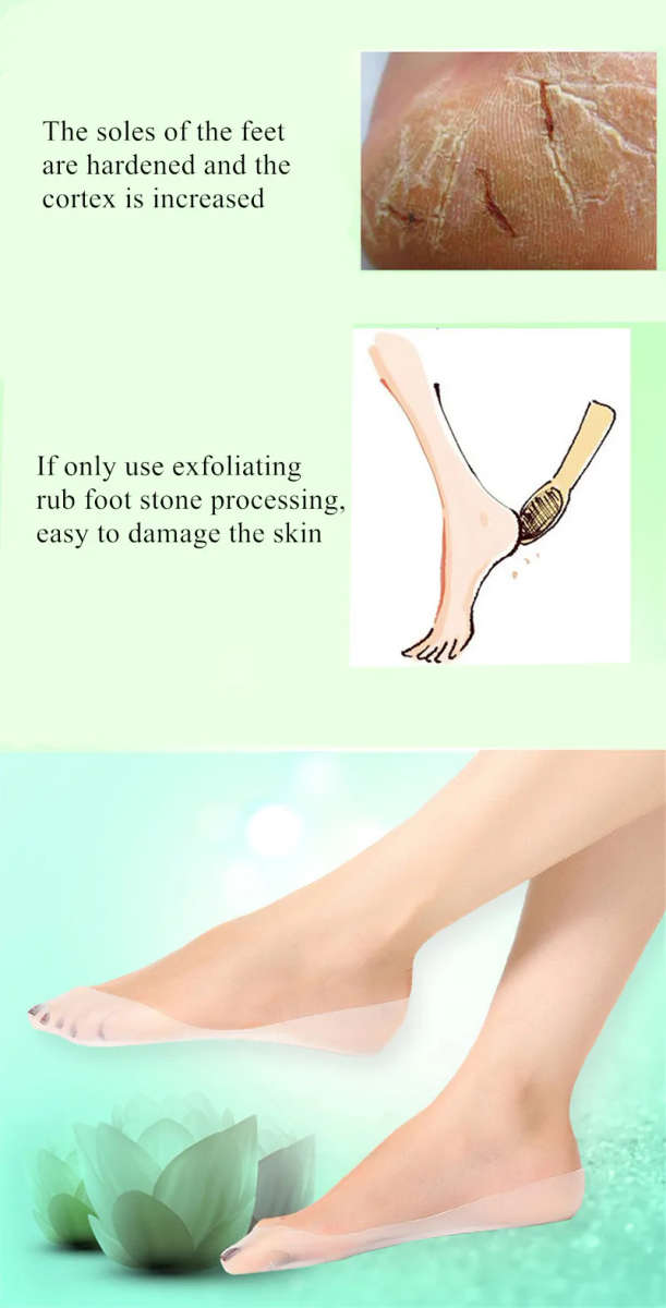 ANTI CRACK SILICONE SOCKS